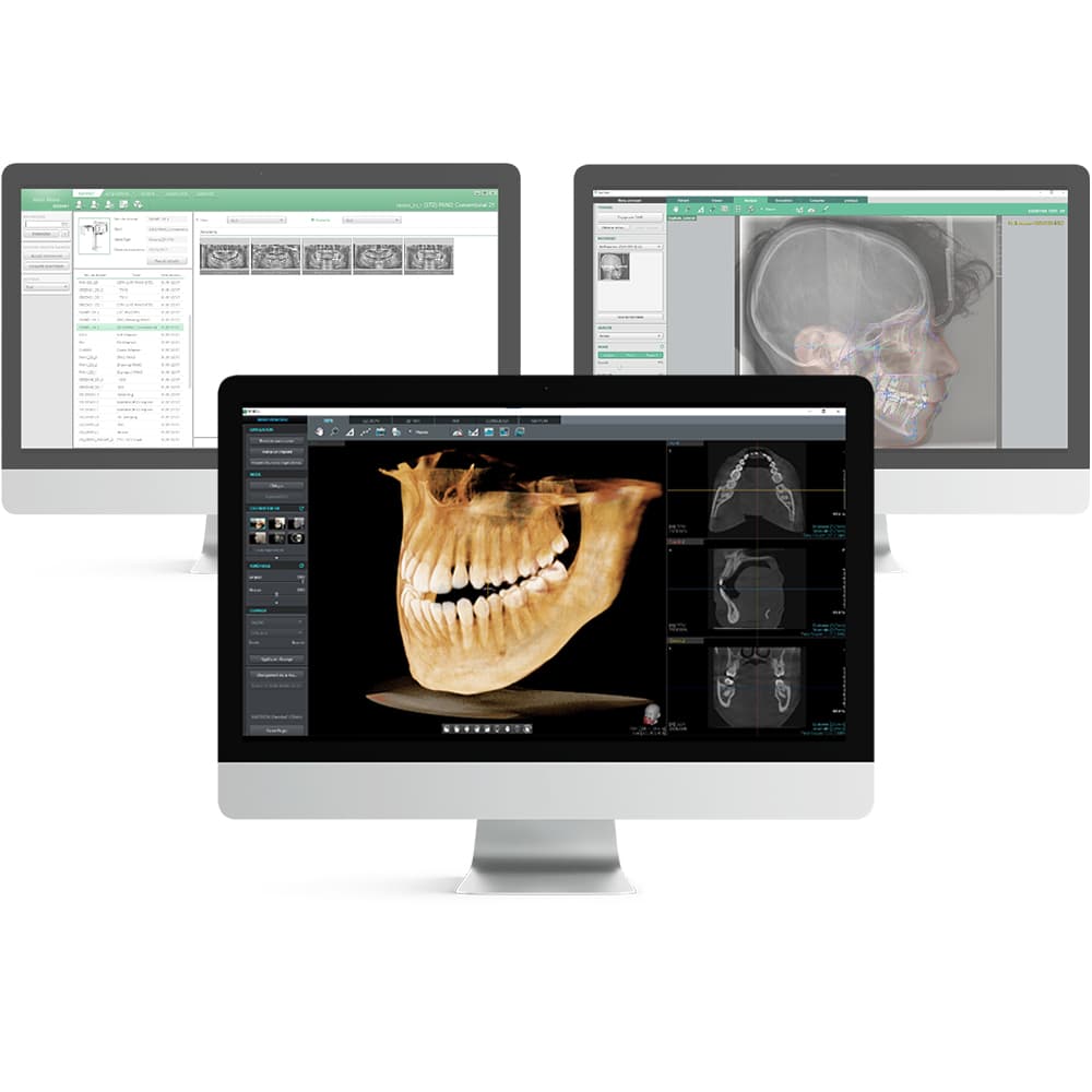 Logiciel d'imagerie Ez3D-i | VATECH