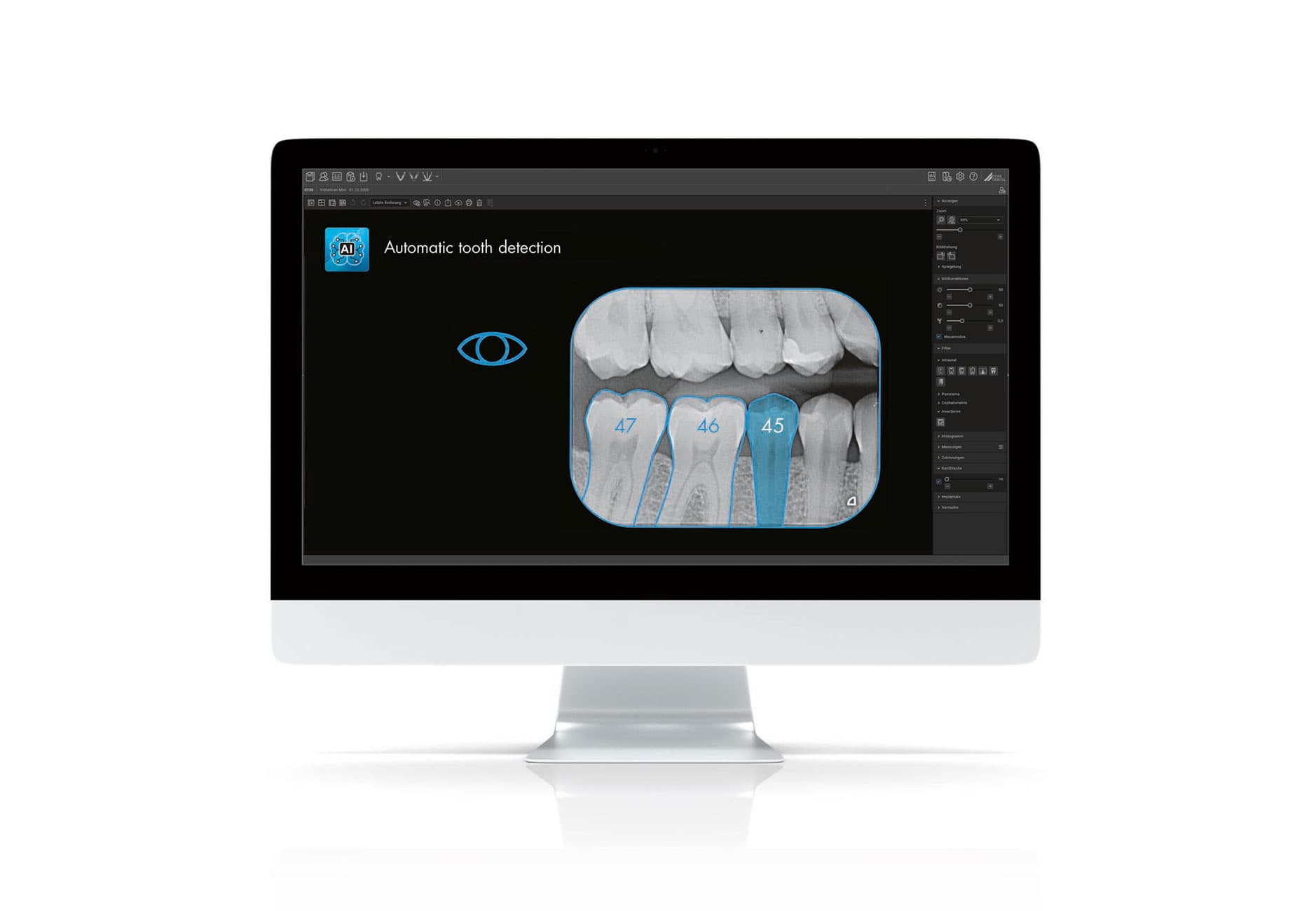 VistaSoft 3D | DÜRR DENTAL